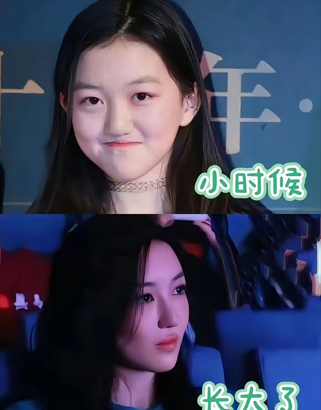 李亚鹏这么有钱，李嫣的嘴巴还是修复的不是很好，上嘴唇还是有点缺陷，不过比小时候好看很多了。家境好，身