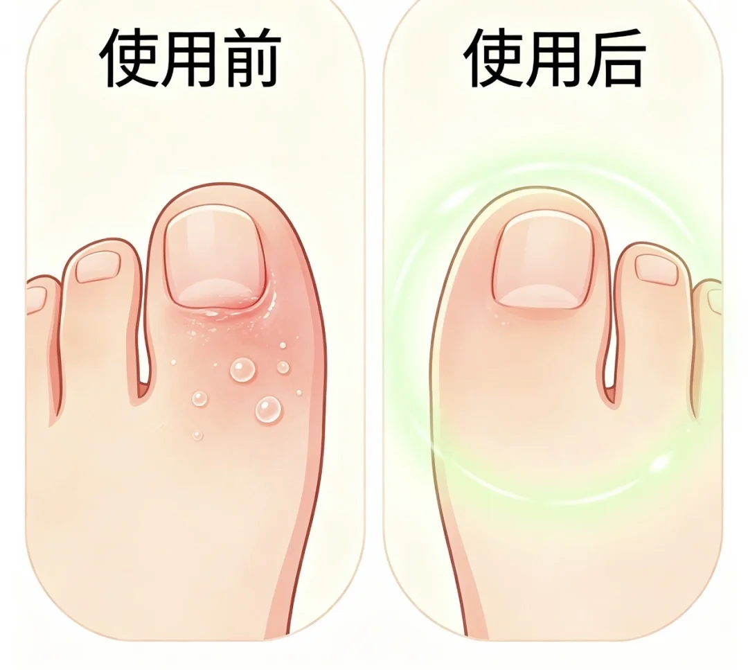 夏天最磨人的“天下第一痒”，又来了吧？