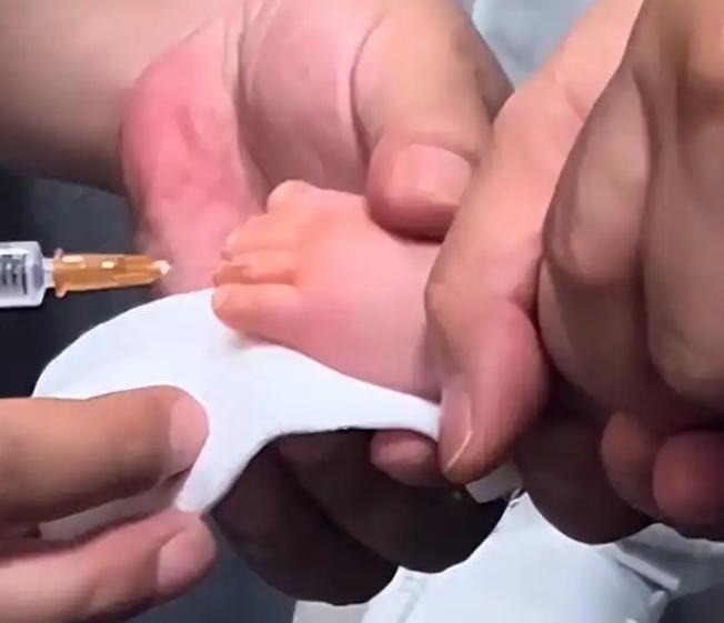 防不胜防！浙江，一个才3个月的宝宝正乖乖喝奶，被邻居突然冲过来的狗一口咬住脚趾！