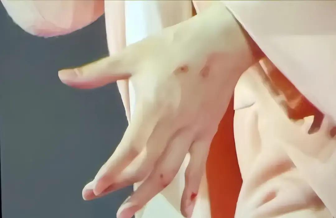 硬汉流血后，第一反应不是疼。是转头找兄弟要亲亲。昨晚小巨蛋，阿信踩空