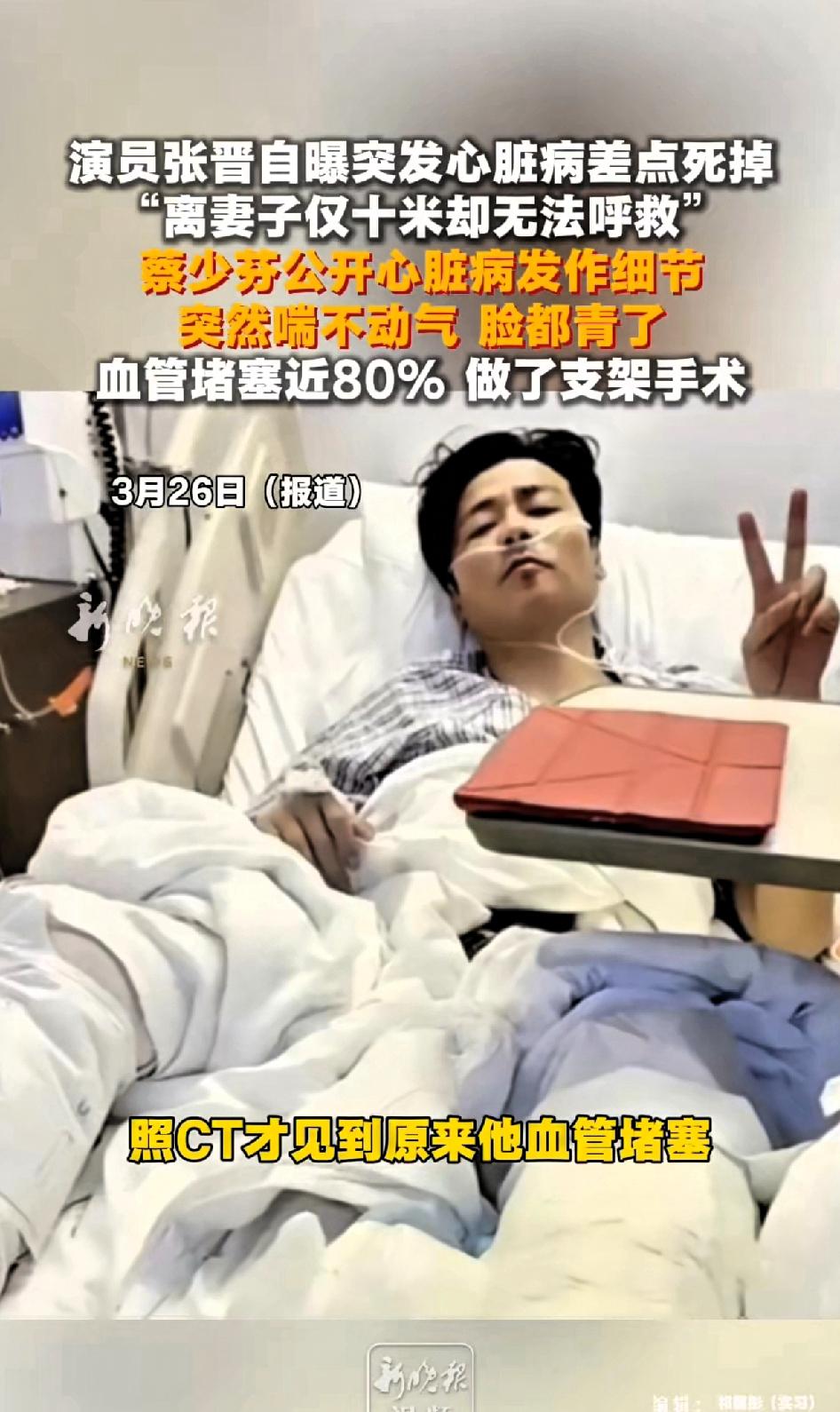 演员张晋自爆突发心脏病差点死掉，离妻子蔡少芬仅十米却无法呼救，蔡少芬公开心脏病发