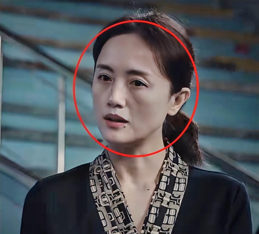 朱媛媛去世，这事早在预料之中！细心的网友早就发现，2023年的朱媛媛脸部凹陷