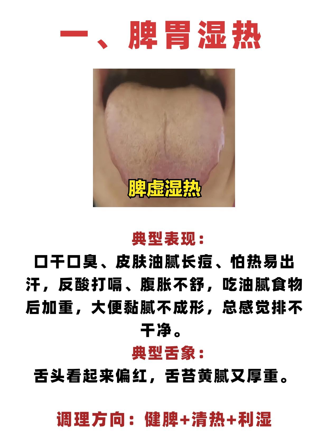 湿热难缠？找准2大根源，中医教你对症祛湿热，无湿一身轻