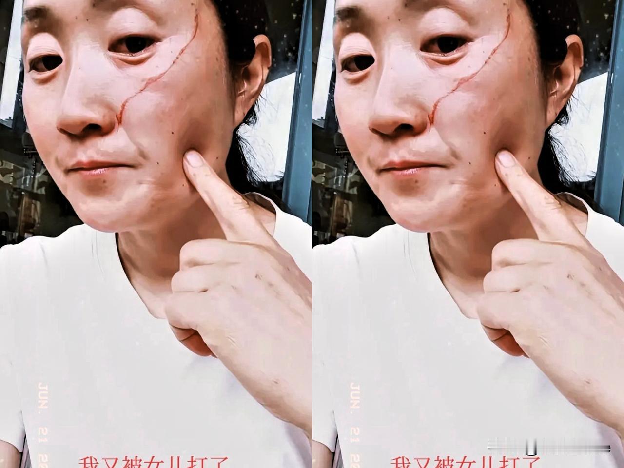 高考结束，女儿竟因妈妈做饭吵醒她，将妈妈脸打破！这女孩高考后日夜颠倒，妈妈好心提