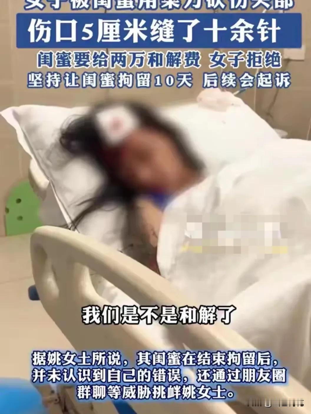 近日，在重庆发生一件离奇的新闻。两名要好的女子居然动起手来，其中一人把另一人砍伤