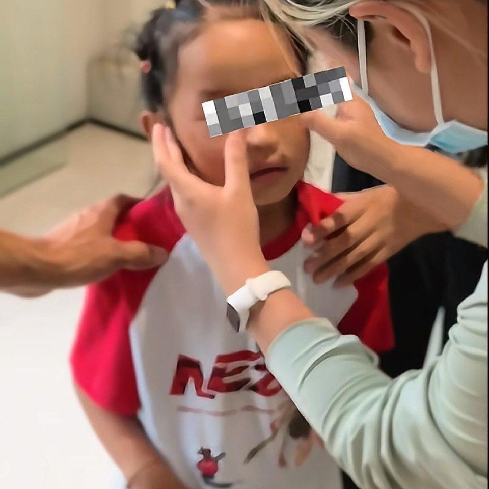 8岁的卓玛终于“找回了”自己的鼻子！小时候因家人下地干活，她被黄鼠狼咬掉鼻子，多