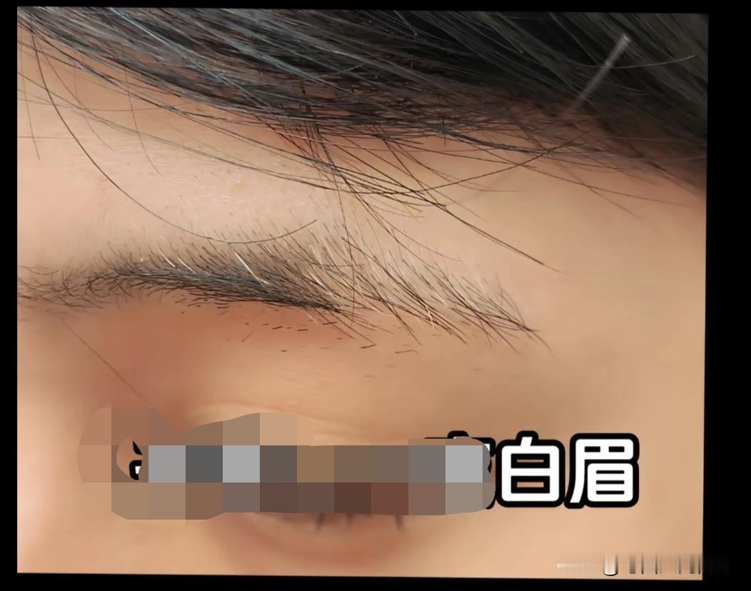 有些玄学，科学真的无法解释。自从左眉长了根白毛后，便祸事连连。我不知从什么