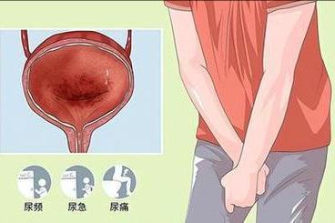 湿热下注、尿路感染：地黄丸加1味，泻火通淋，尿频尿痛一用就稳大家好，我是中