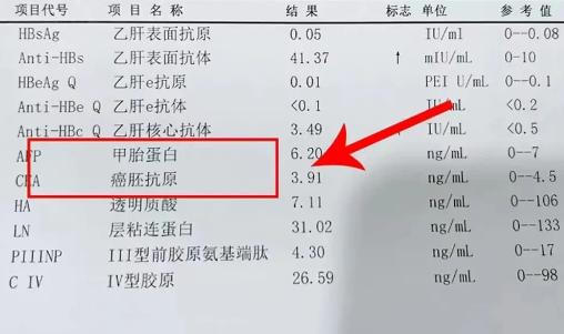 肝脏检查揭秘！这两项异常，肝癌风险需警惕！想要有效预防肝癌的发生，做好防癌筛查