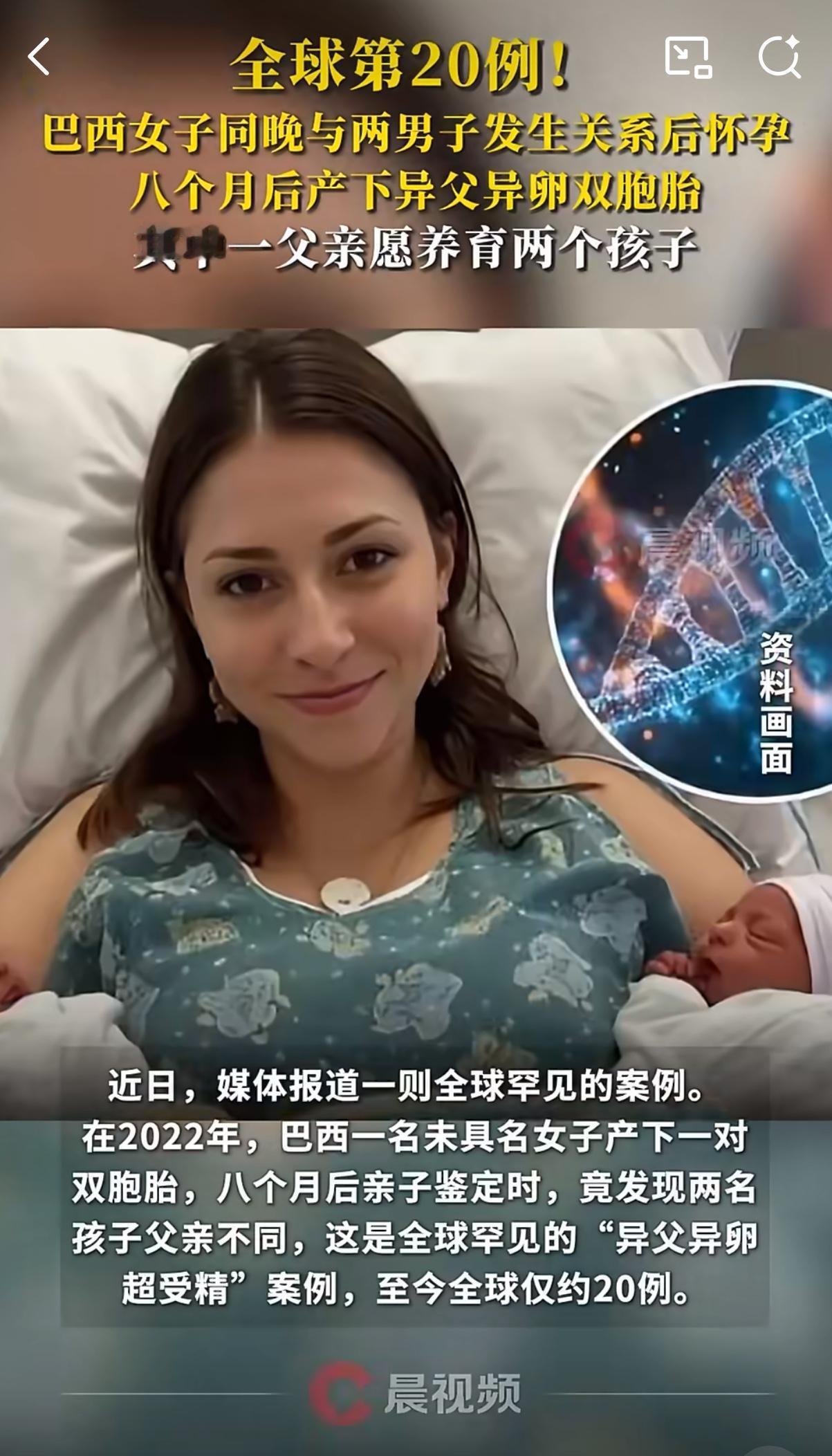 双胞胎居然有两个不同的爹？巴西这起百万分之一概率的事儿，听着像电视剧剧情，却真真