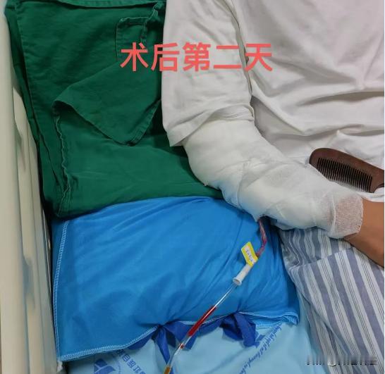 无锡，在课间休息的时候，初三的几位学生团坐在一起，准备玩掰手腕游戏。小张跟小刘也