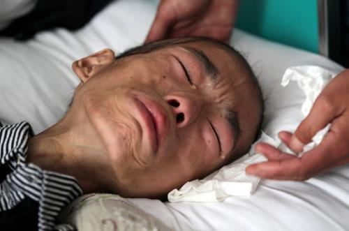 肾脏好不好自己检查! 出现4个症状, 医生劝你赶紧养肾