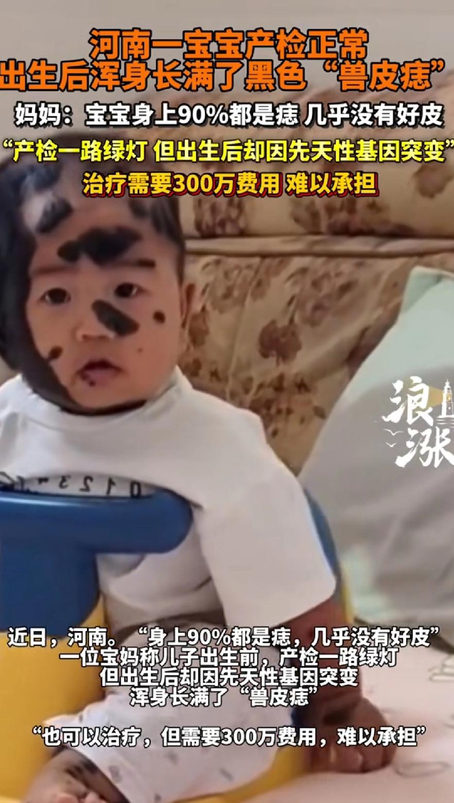 河南一宝宝产检正常，出生后浑身长满了黑色“兽皮痣”，妈妈遇到这种情况会自责，觉得