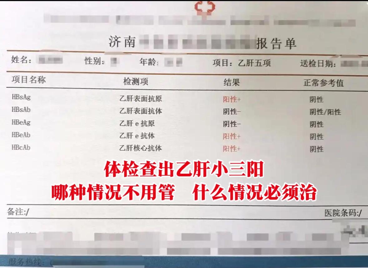 乙肝小三阳，一种不用“管”，一种必须治！     我是肝病主任陈士俊教...