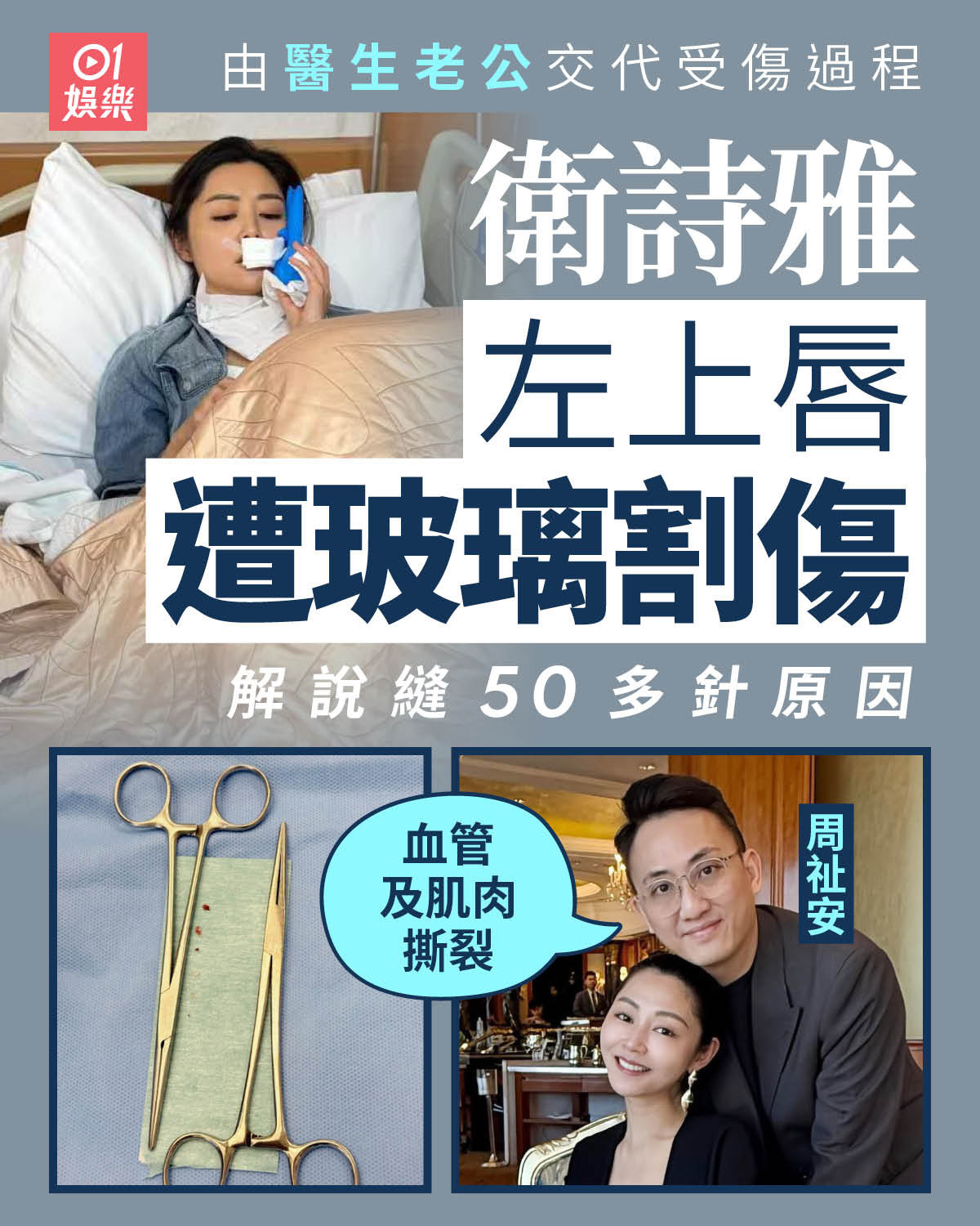 卫诗雅的丈夫在社交平台发文，代卫诗雅交代受伤过程，以及需缝50多针的原因。他表示