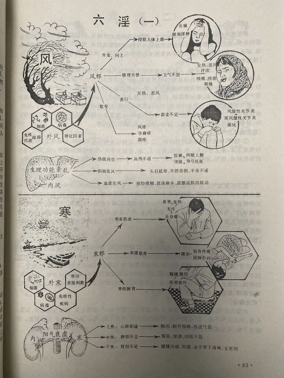 六淫辨证原来这么好学，原来的老书真有东西