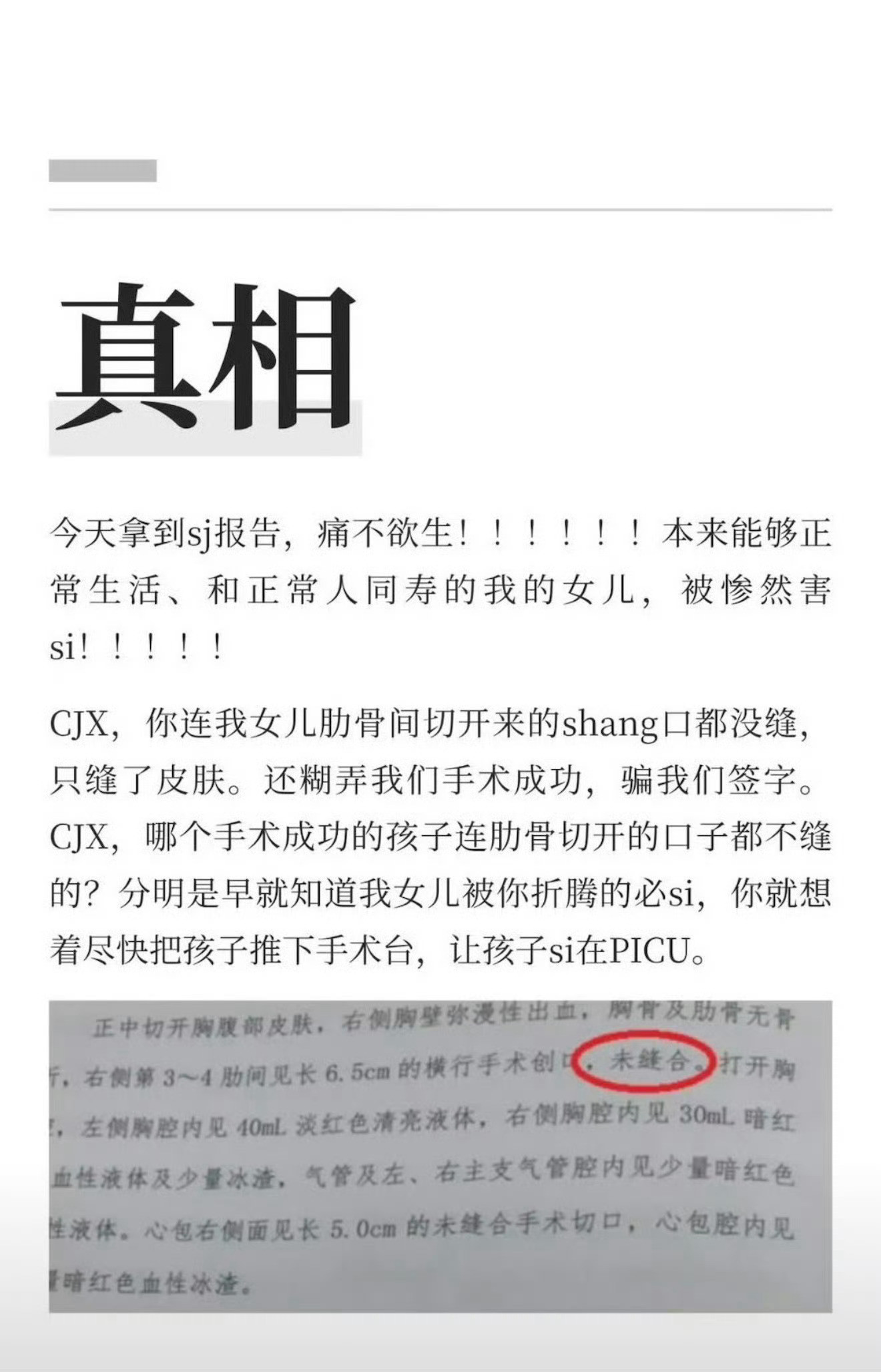 小洛熙尸检报告什么根本不需要手术！！！这才是新闻机构，挺你们尸检结果出来了:1
