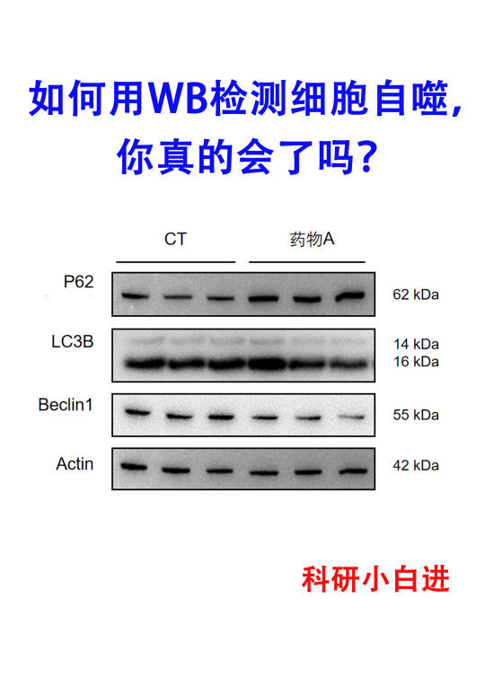 🔥干货分享｜一文教会用wb 技术检测细胞自噬