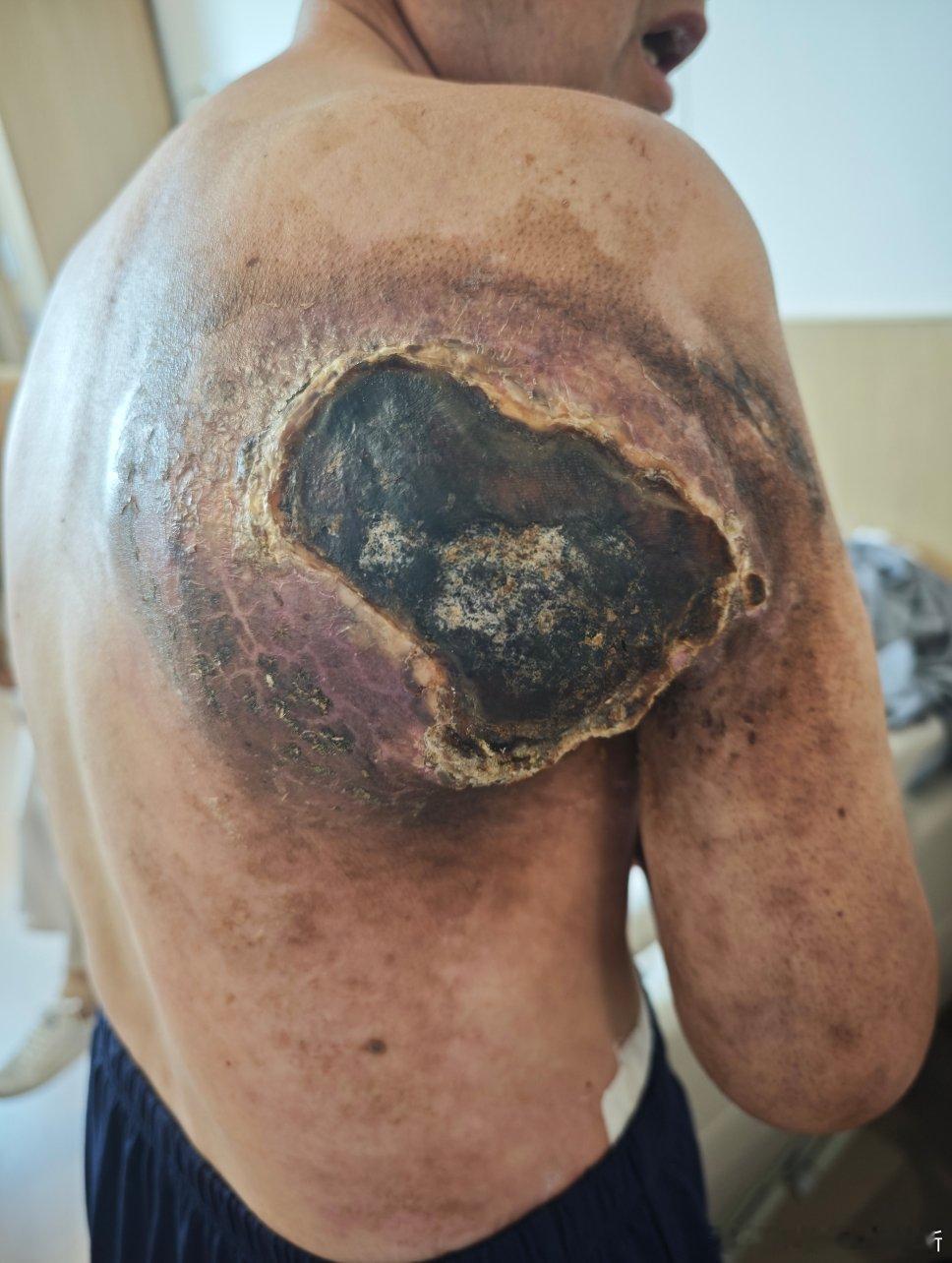 我的门诊故事周四上午门诊，又是一番忙碌。研究生小李、规培水医师随诊。其中几个