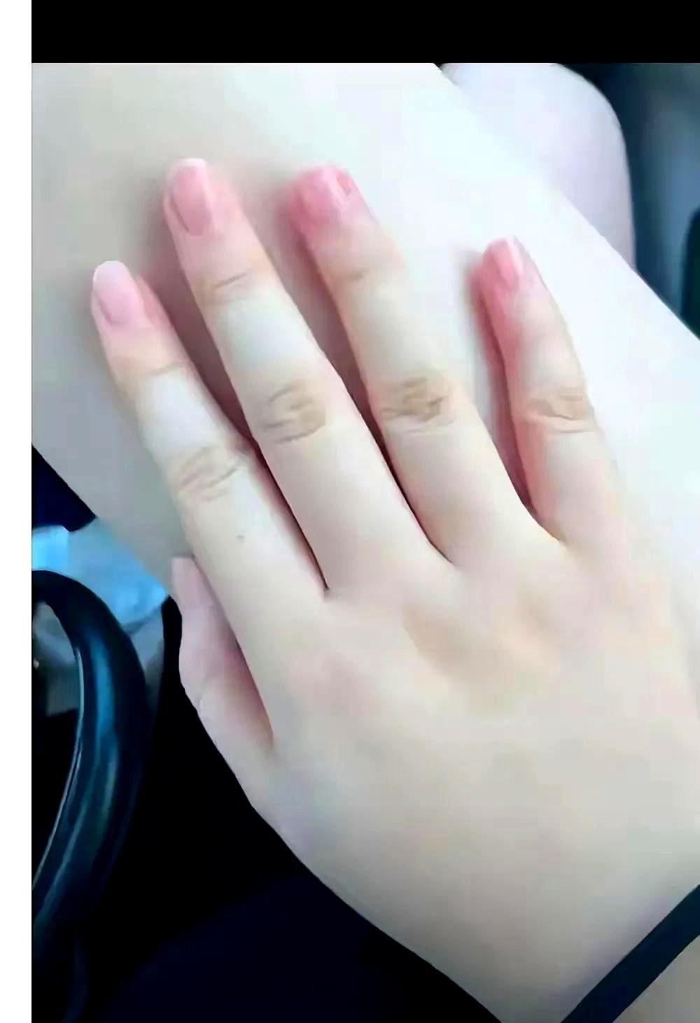 最近老是感觉手指缝有点痒，还有就是老感觉手没劲。有时候我家老郑（我老公）冲凉的