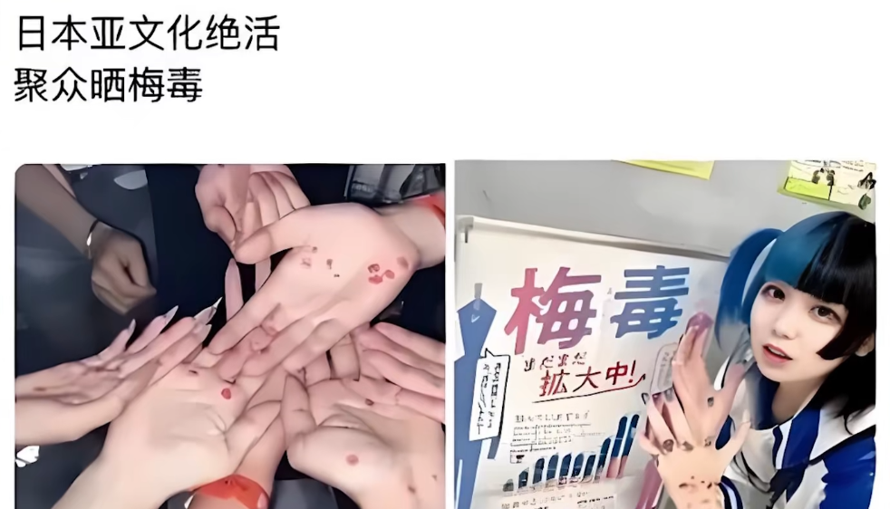 日本公共卫生彻底翻车，梅毒感染人数疯狂暴涨，直接创下多年新高。更要命的是，治疗梅毒的独家救命药被美国