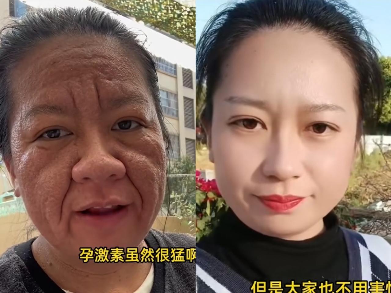 云南昆明，32岁的阿芹，本是个漂亮宝妈，孕前皮肤细腻、五官精致，谁料，怀孕刚满2