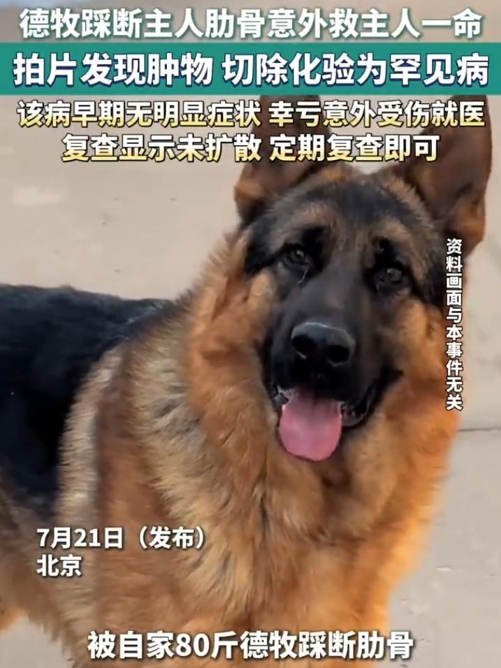 解释不清了！北京一只80斤的牧羊犬，突然跳主人身上，把她踩骨折了，谁料到医院一看