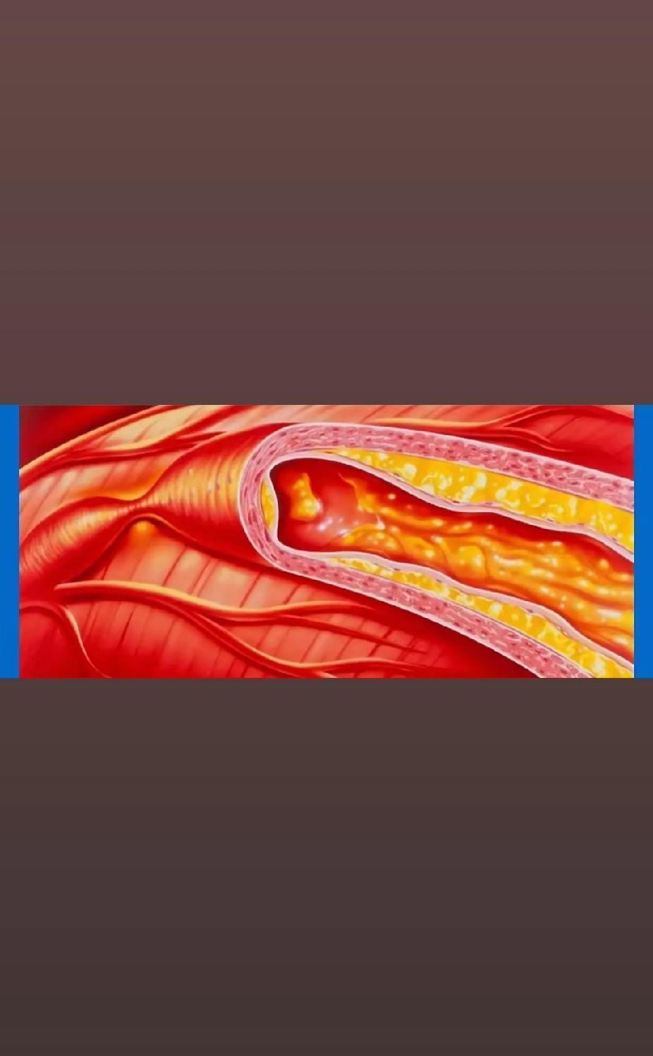 血管通不通畅，脸和腿上其实藏着小提示！这6个表现可别忽视，说不定能在关键时刻帮你