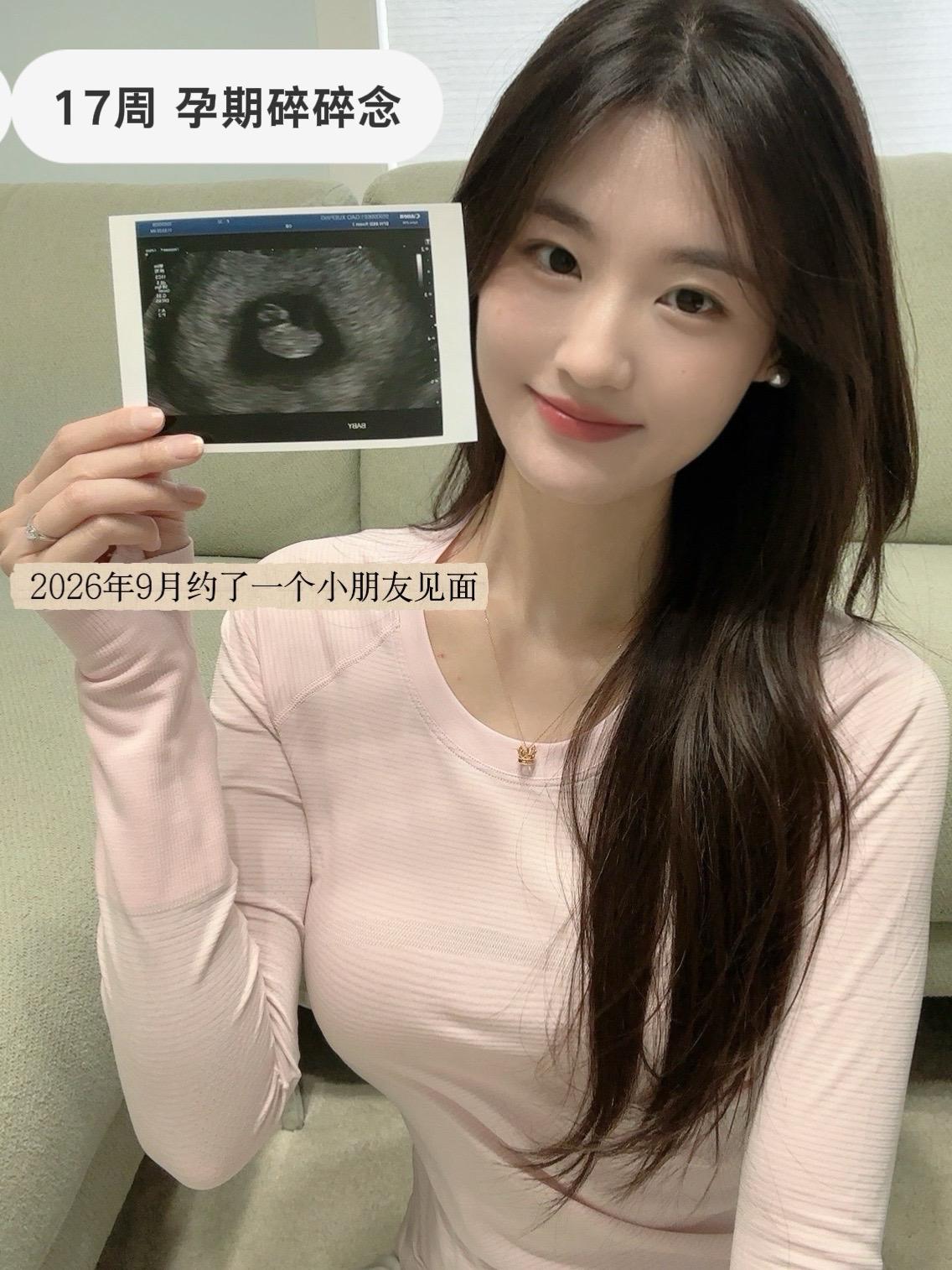 17周｜有爱的孕期记录。想说的太多，却不知道从哪一周开始讲起，那些没说...