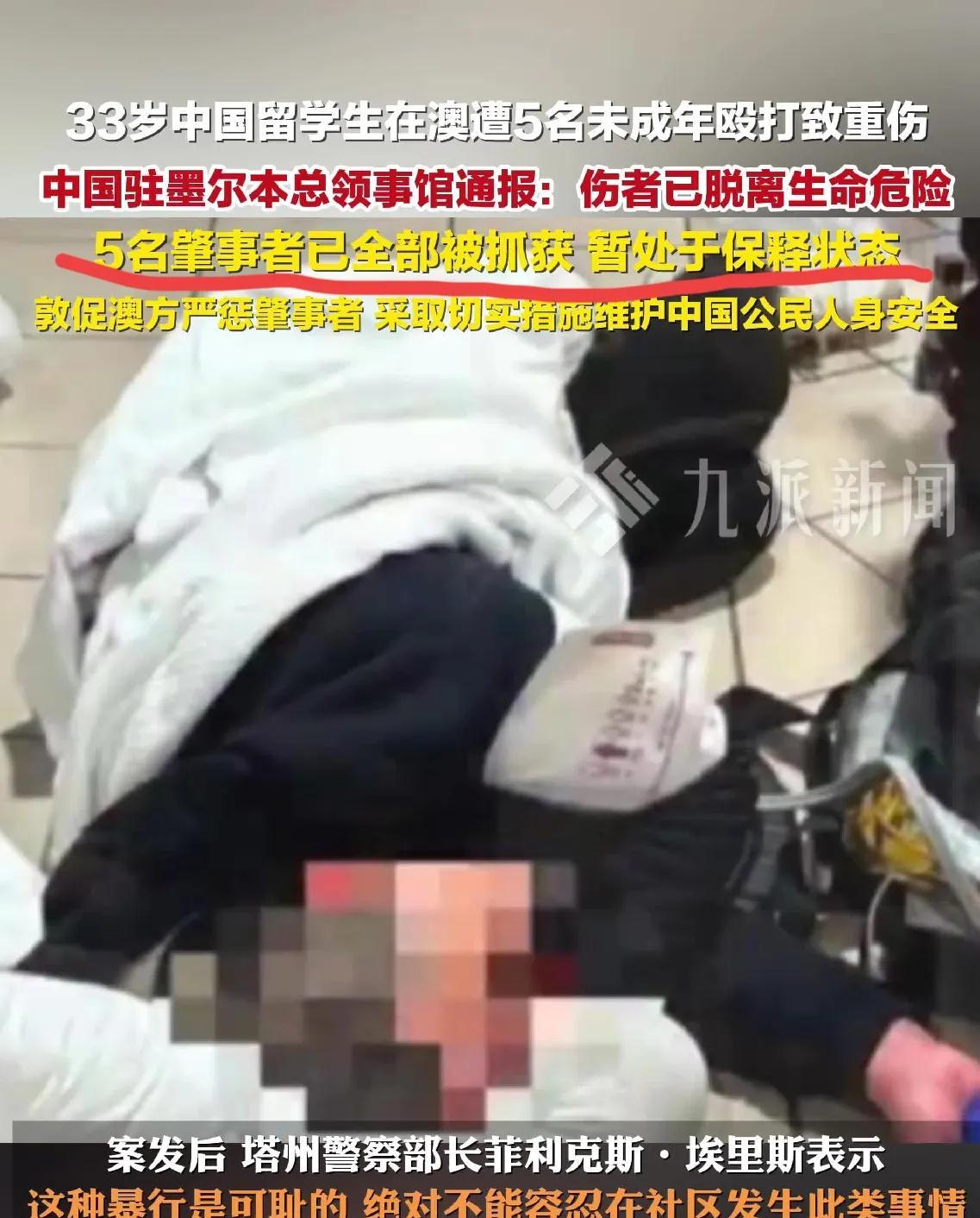 澳大利亚33岁的中国留学生，被一群本地人打得那叫一个惨，脑部出血、颅骨和脸都骨折
