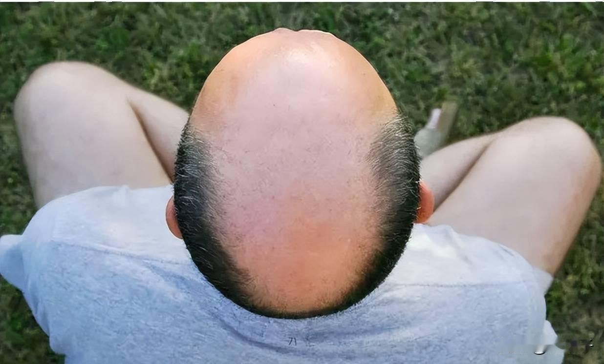 男人真正的衰老，从来不是白发皱纹，而是身体悄无声息的退步，只有自己深有体会。