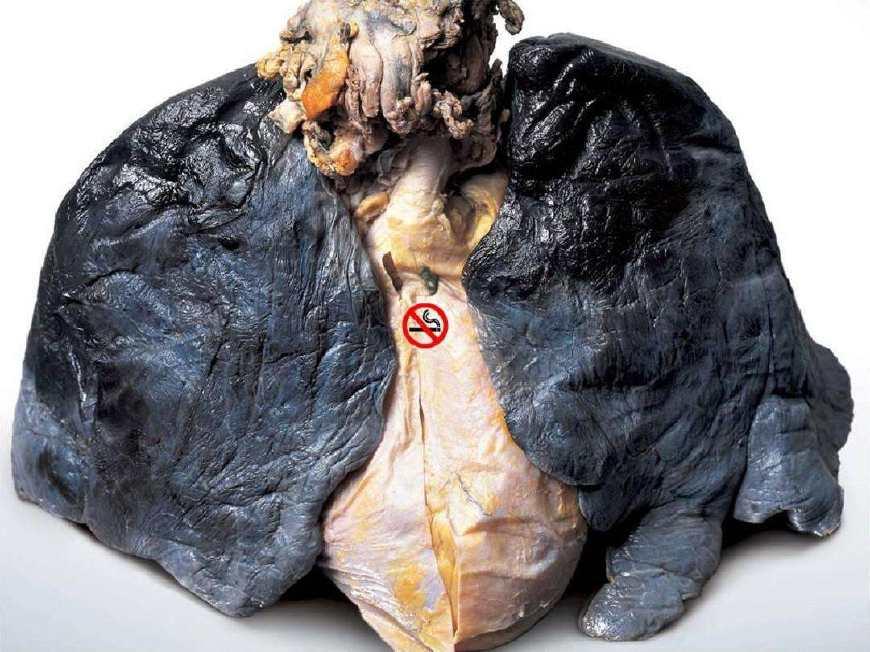 戒烟后身体会发生3个阶段的神奇变化, 肺部还能恢复健康吗?