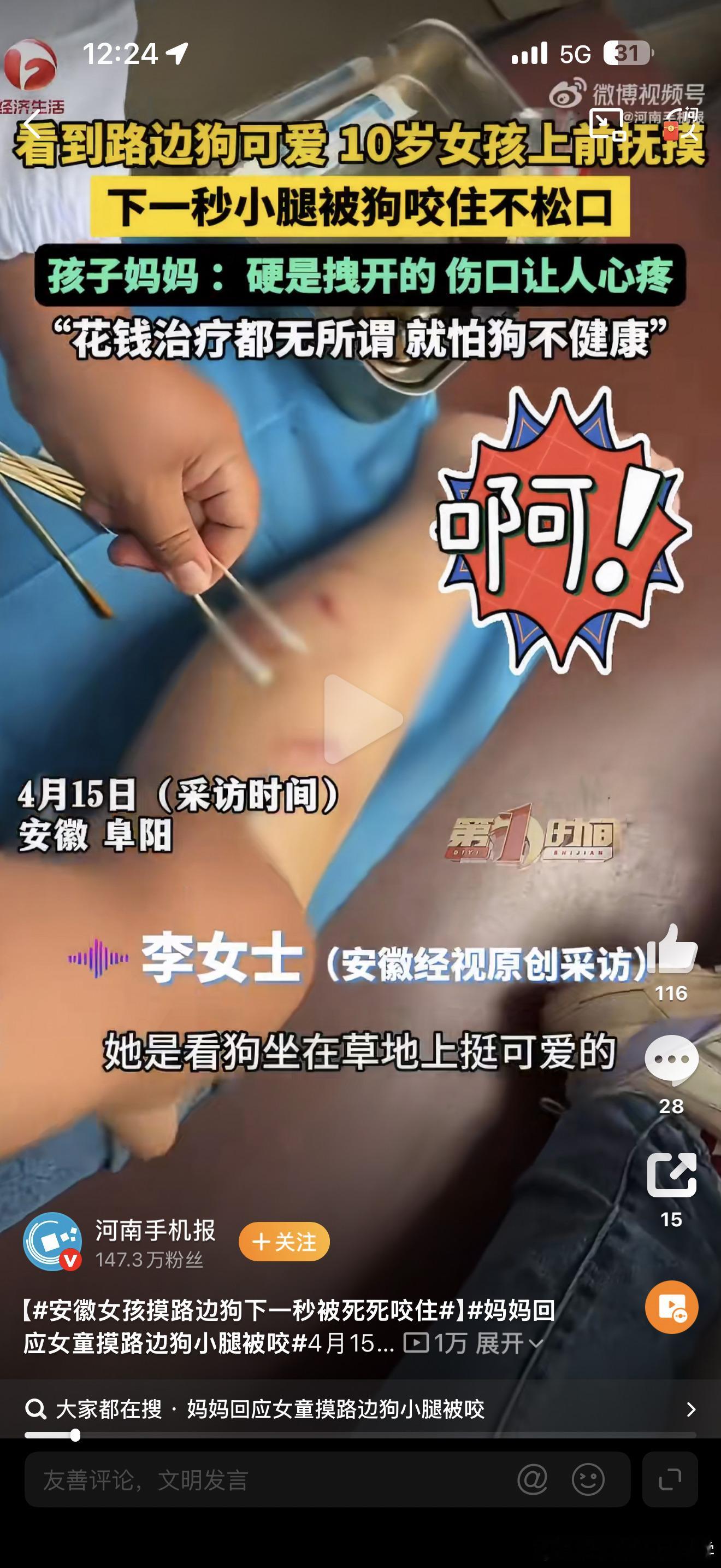 安徽女孩摸路边狗下一秒被死死咬住我们一直被教育：狗是人类的朋友但我们很少知道的是