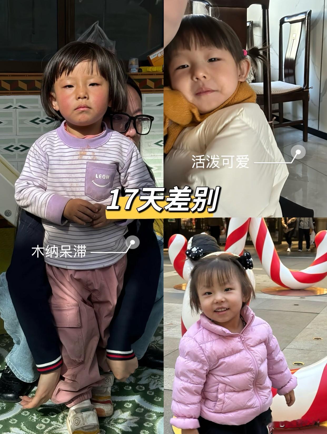 看到涵涵小姑娘是真心疼！仅仅过去了17天，小孩天真烂漫的眼睛感觉不到光了，有