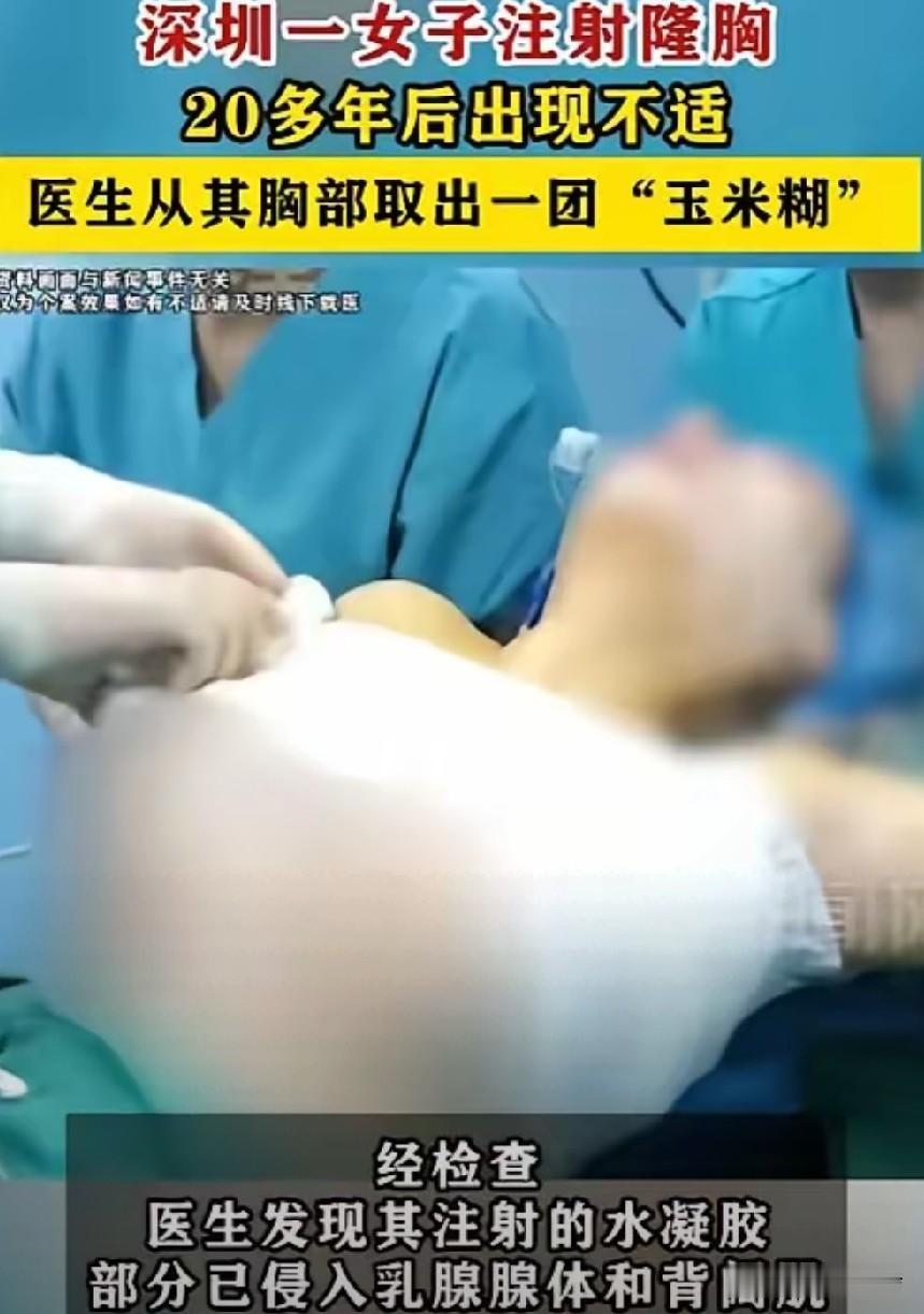 20年前丰胸的透明凝胶，做手术切开成团黄白色的玉米糊，全国约三十万女性带着这个隐