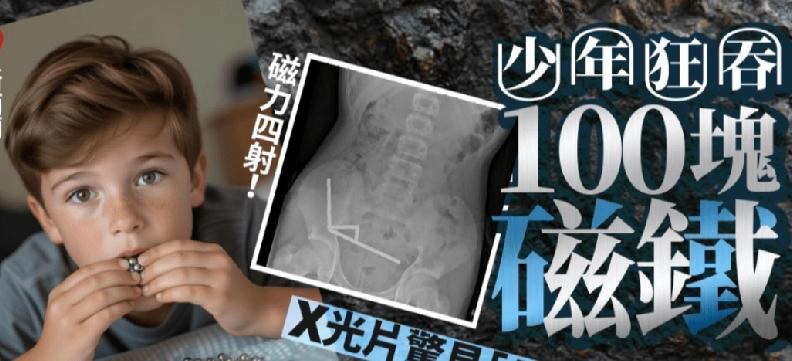 新西兰发生一起离奇医疗案例，一名13岁少年吞下多达100块从中国电商平台Temu