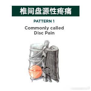 【4种不同腰痛】昨天讲了盘源性腰痛，今天来补充另外3种疼痛类型，解析腰痛原因👇