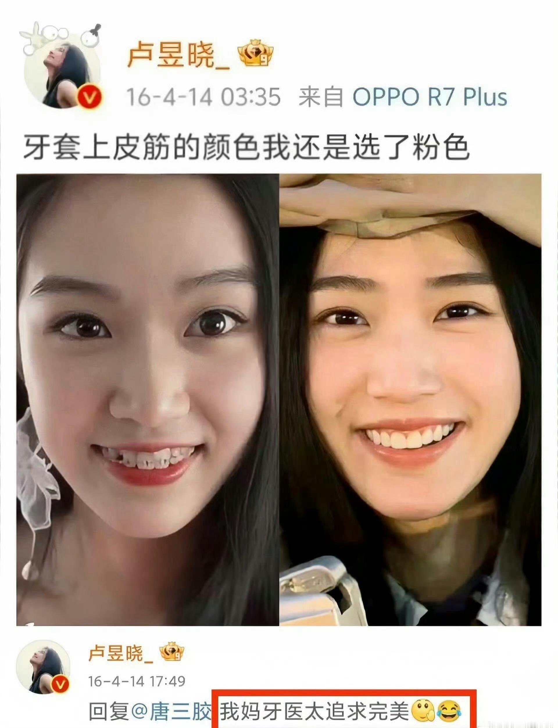 真羡慕卢昱晓有个牙医妈