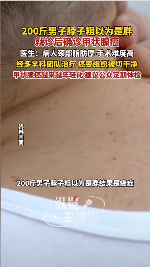 “悲剧还是发生了！”近日，一31岁男子发现脖子比之前粗了，还以为是肥胖导致的，直