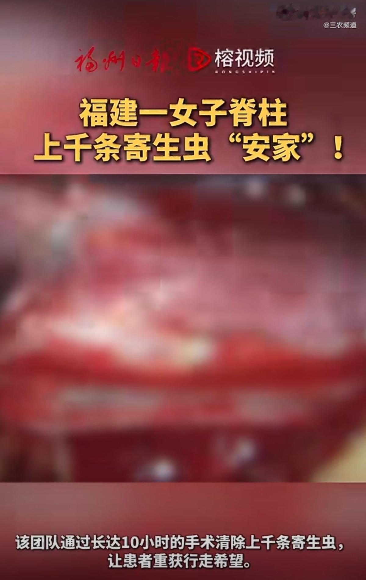 福建福州57岁农妇被怪病缠两年，腰腿疼到差点瘫痪，谁都没想到，罪魁祸首竟是脊