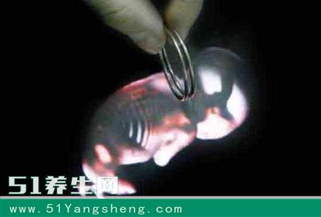 二胎生完, 孕妈是结扎还是上环好? 这个答案最霸气