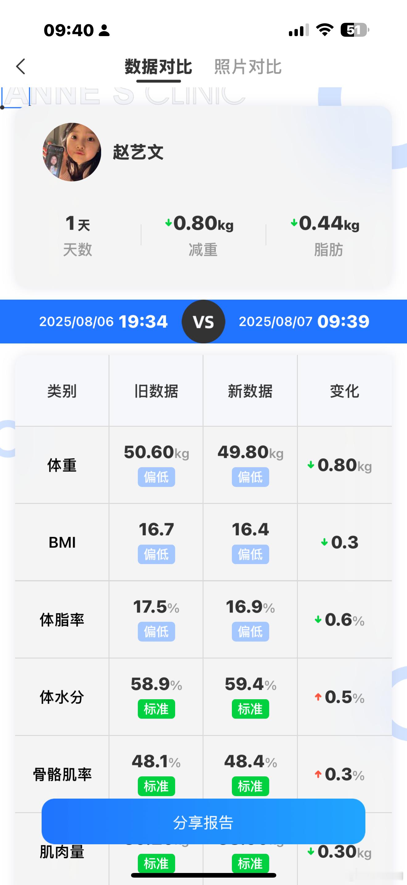 昨天就喝了两碗粥洗脸都在拉伸[跪了]你就掉这么点​​​