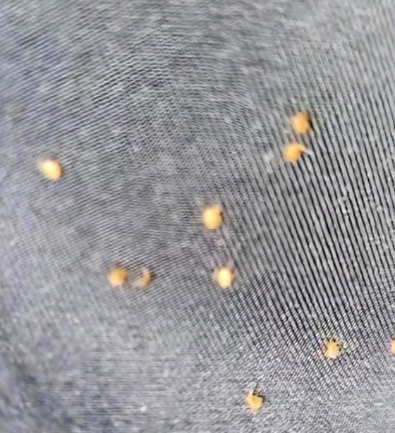 现在农村蜱虫已经到了泛滥成灾的地步，全面启动冬季烧山已经刻不容缓了。说到烧东