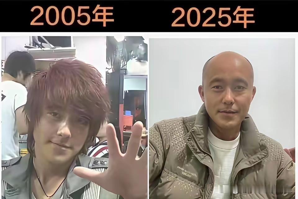 不得不说，20年前后，简直判若两人！[捂脸哭][捂脸哭][捂脸哭]