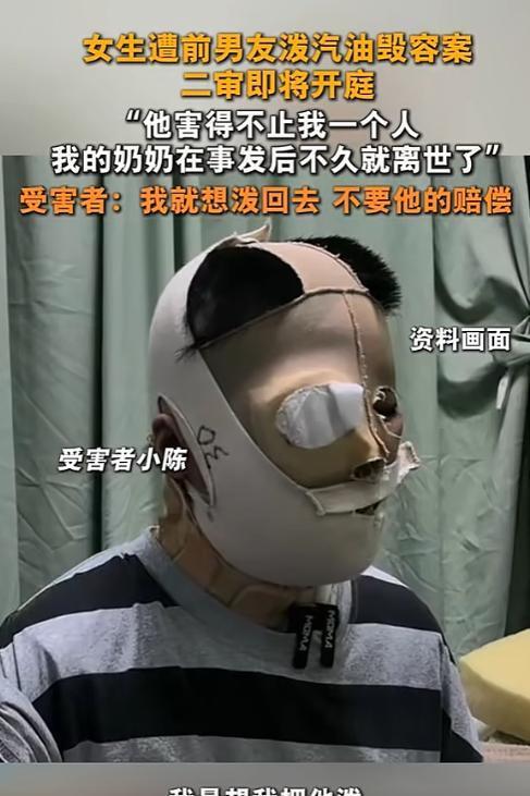 “我不要赔偿，我要泼回去！”湖北恩施，女生遭前男友两次往身上泼汽油点火，女生毁容
