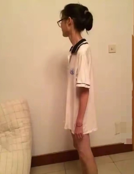 侄女来市里检查，顺便拐我家了。才几个月没见侄女，吓我一大跳。短短一两个月，竟然瘦
