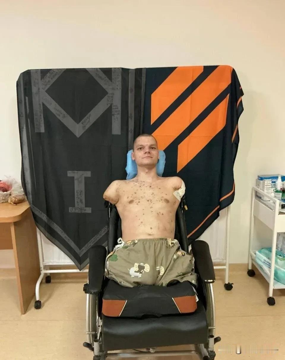 这是一名失去四肢的乌克兰伤残士兵。他终于不用上战场了。可是他在大后方也没有得