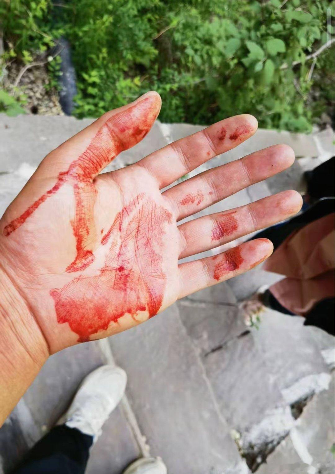 飞来横祸具象化，网友去峡谷景区玩，不小心被落石砸伤了头