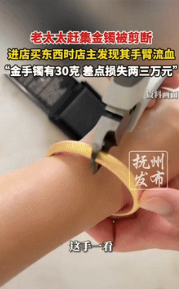 “简直防不胜防！”山东威海，一老太进店购物时，店主发现她手腕处流血了，老太闻言抬