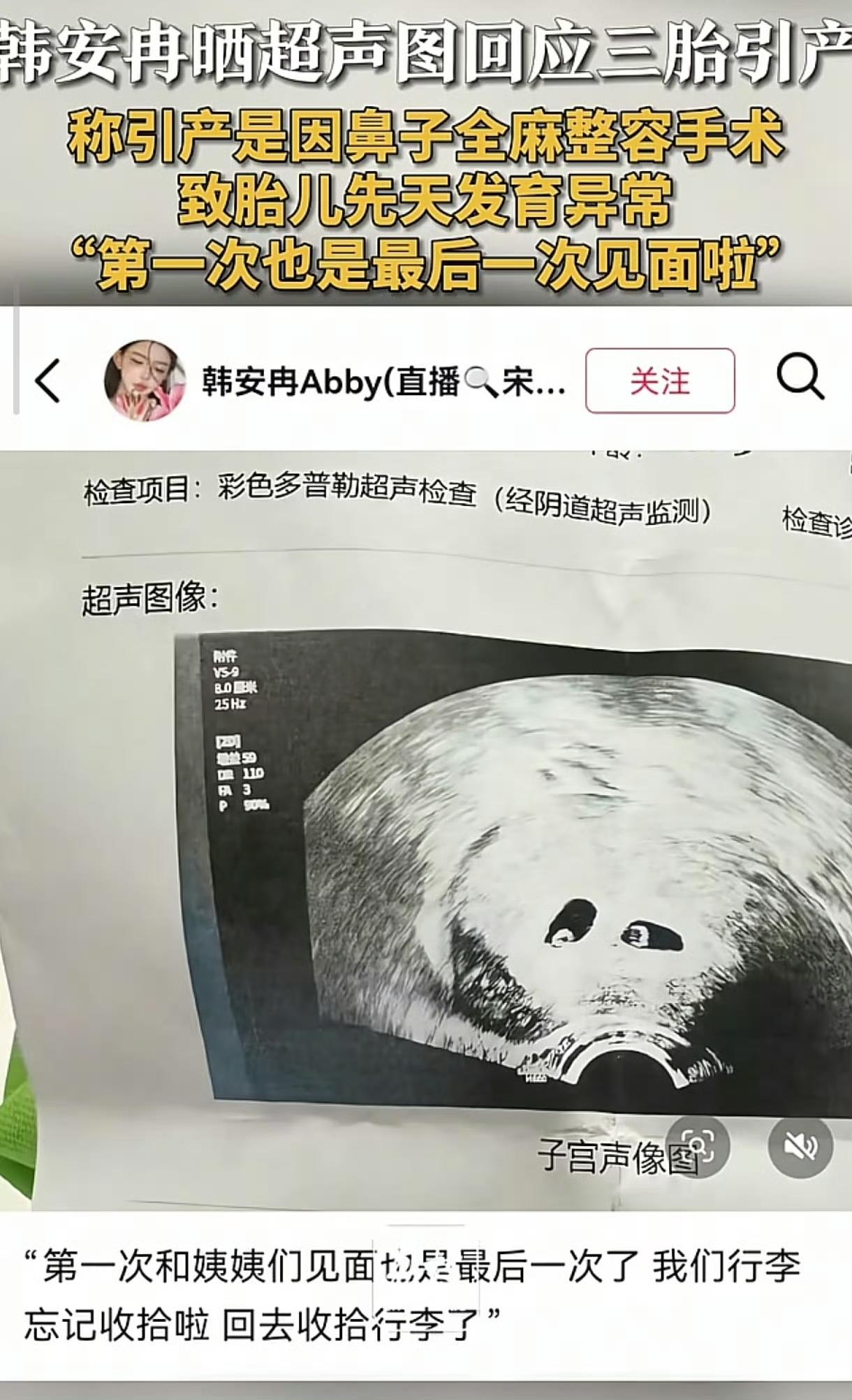 💥韩安冉三胎引产后三月再做人流！手术签字成罗生门，全网炸锅：是真伤痛还是新剧本